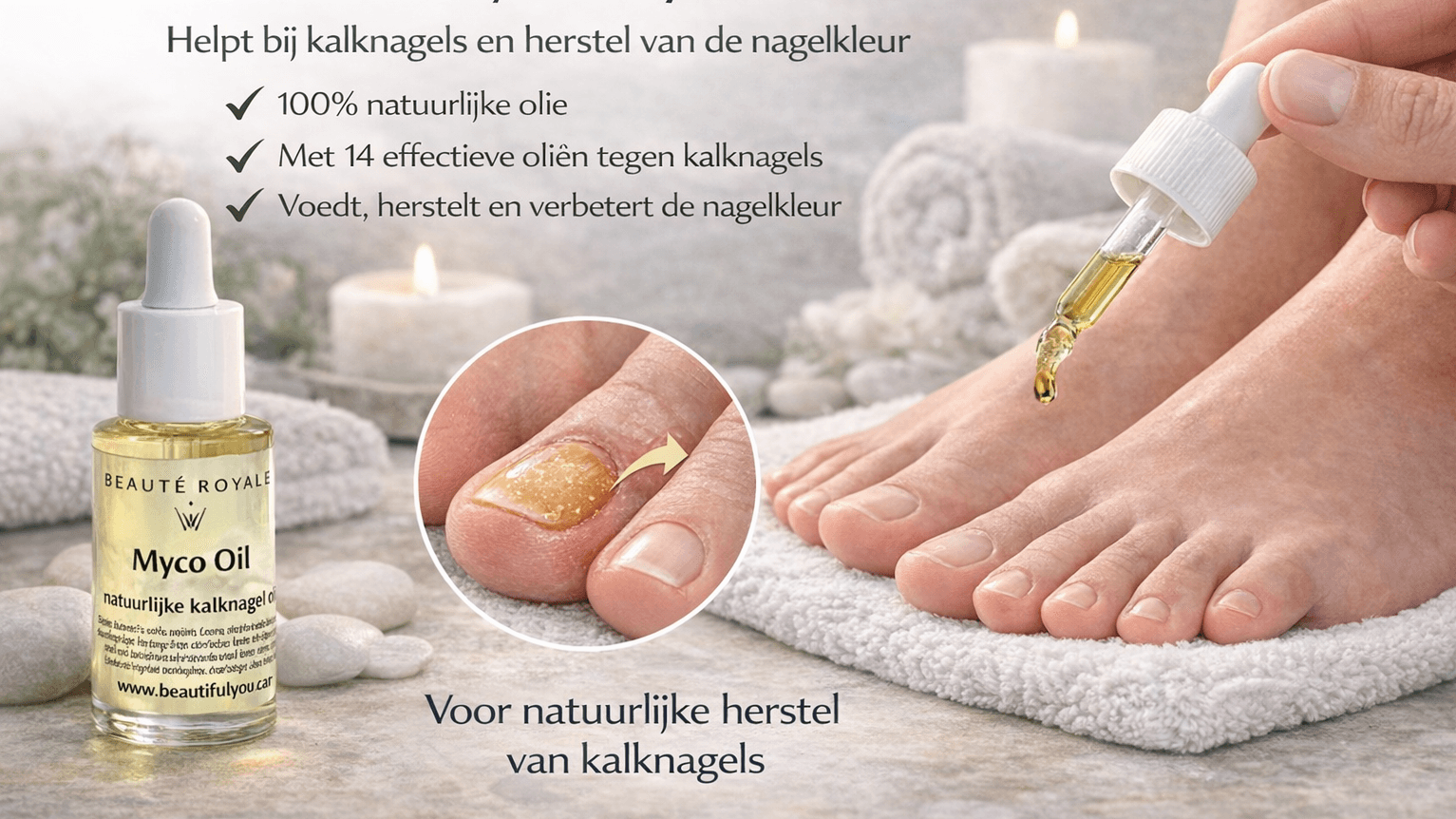 Natuurlijke oplossing voor kalknagels